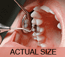 Actual Size