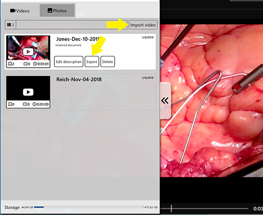 Gallery Import and Export Buttons