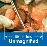 Unmagnified